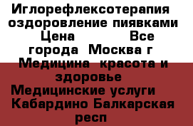 Иглорефлексотерапия, оздоровление пиявками › Цена ­ 3 000 - Все города, Москва г. Медицина, красота и здоровье » Медицинские услуги   . Кабардино-Балкарская респ.